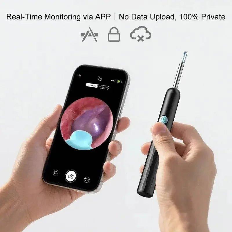 Smart ear cleaning tool with real-time app monitoring, private no data upload, handheld design