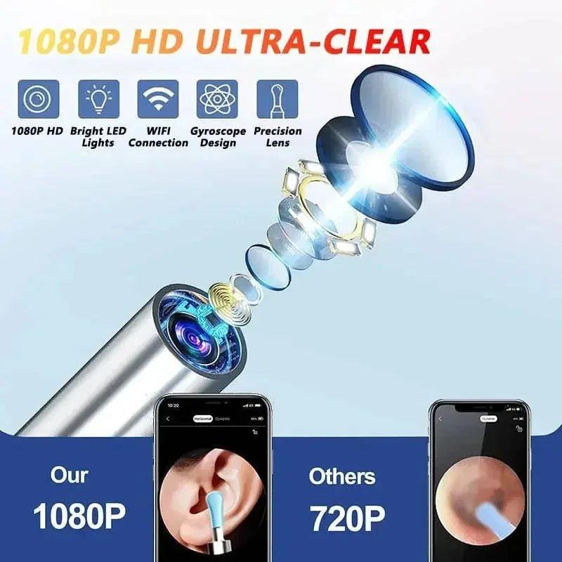 1080P HD ear camera with WiFi, LED lights, and precision lens for ultra-clear ear inspection
