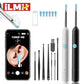 iLMi HD ear cleaning kit with smartphone camera view, reusable tips, and LED light for safe earwax removal